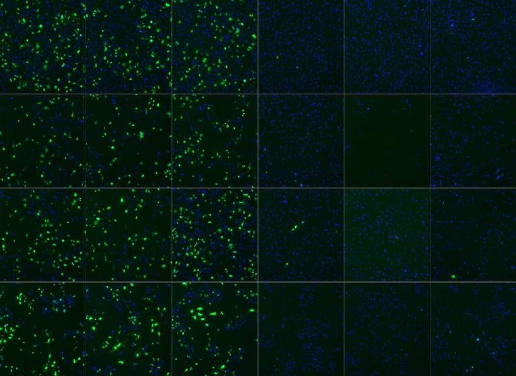 Why Do We Need AutomationComposite caspase